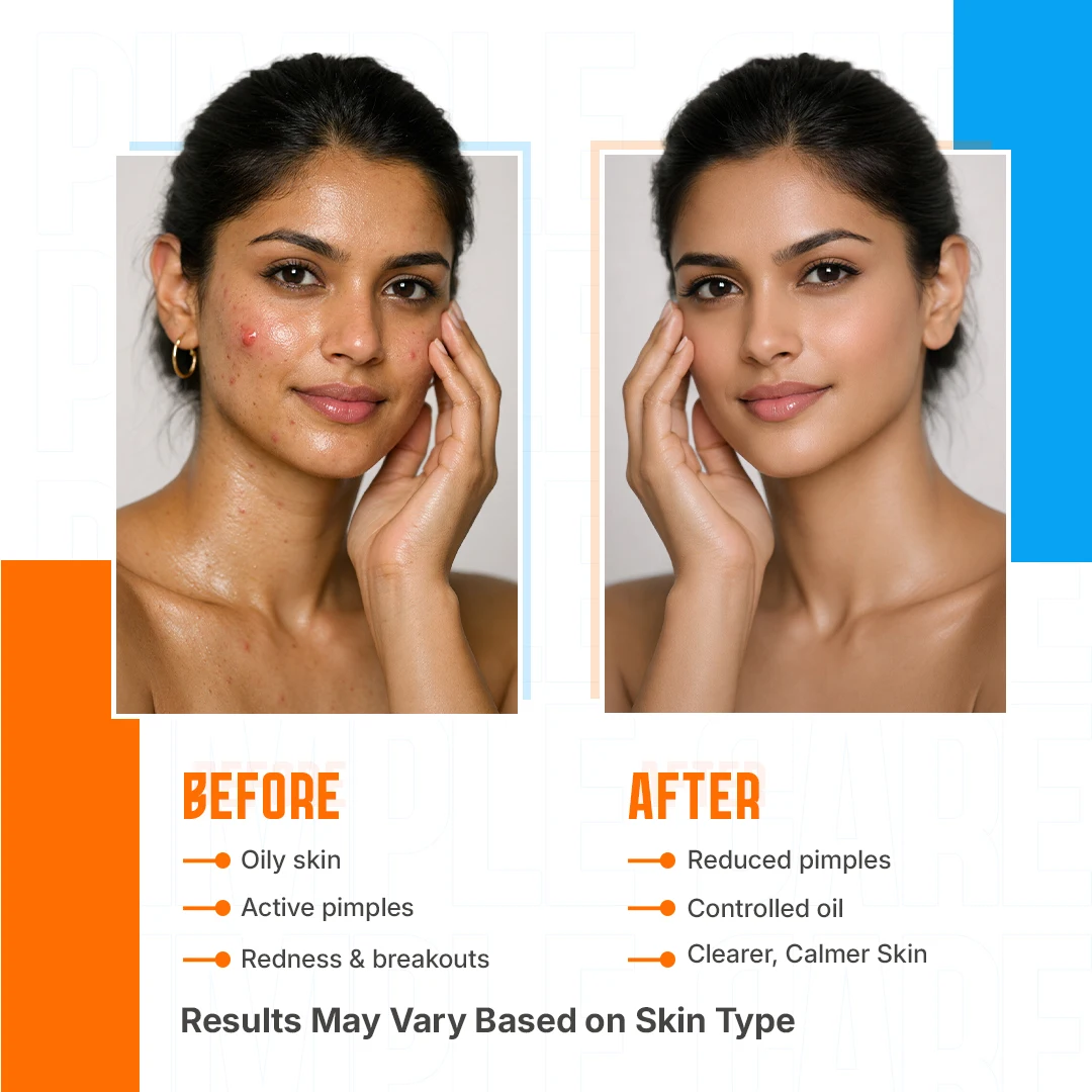 buy pimple care face wash